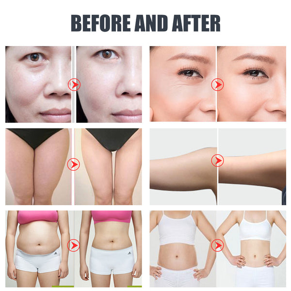 SQ47B Pro 6-in-1 40K cavitatieapparaat