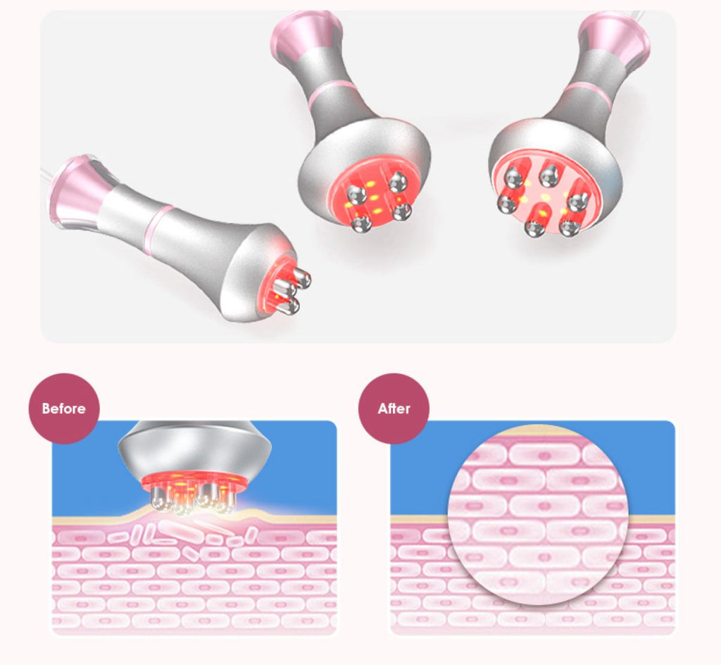 SQ121B Pro 6-in-1 80K cavitatieapparaat
