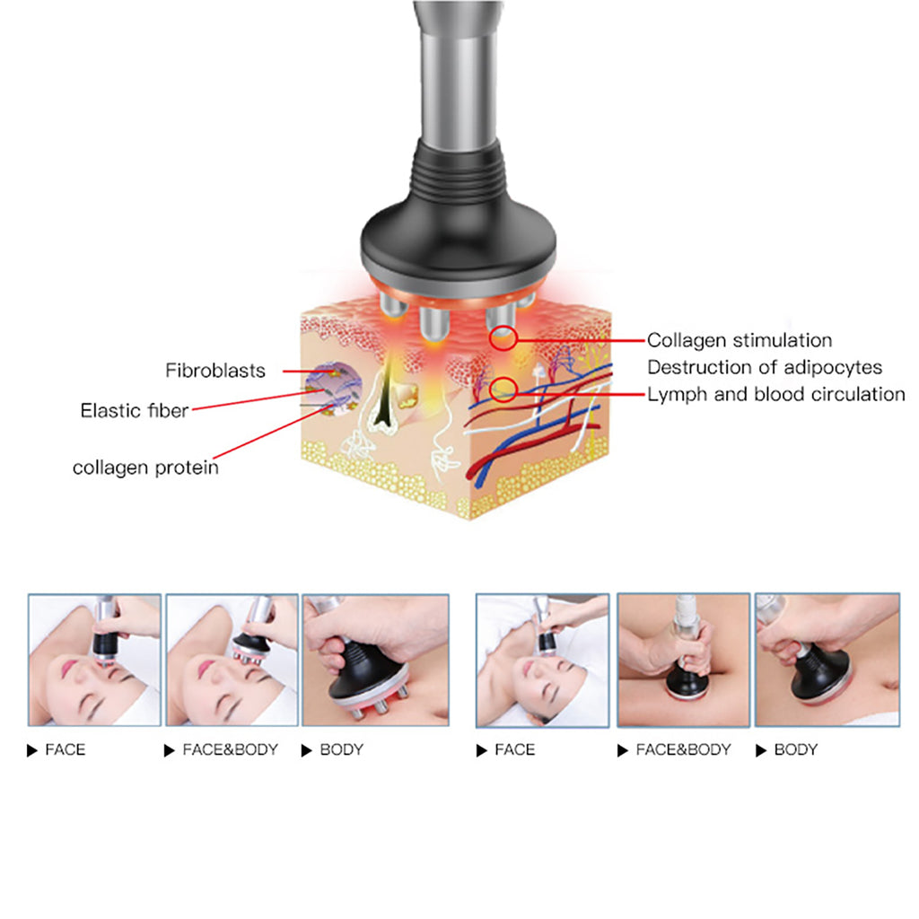 SQ41 7-in-1 40K-cavitatie- en RF-apparaat